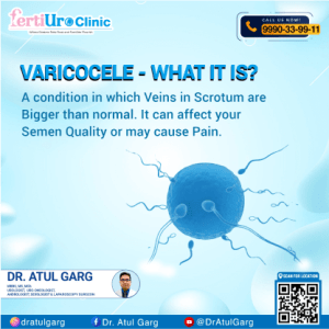 varicocele